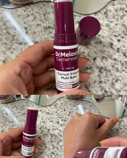 セメンリトカルシウムアンプル+セメンリトカルシウムクリーム/Dr.Melaxin/スキンケアキットを使ったクチコミ(4枚目)