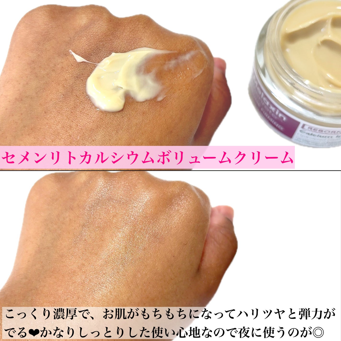 セメンリトカルシウムアンプル+セメンリトカルシウムクリーム/Dr.Melaxin/スキンケアキットを使ったクチコミ(5枚目)