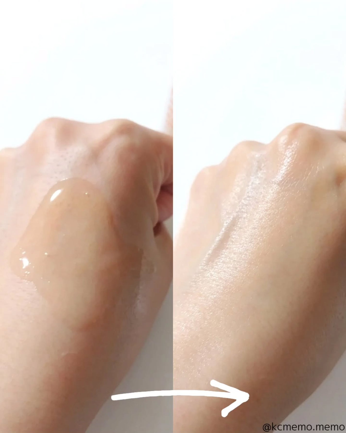 ビタペアCPDRN水潤セラム/ネイチャーリパブリック/美容液を使ったクチコミ(4枚目)