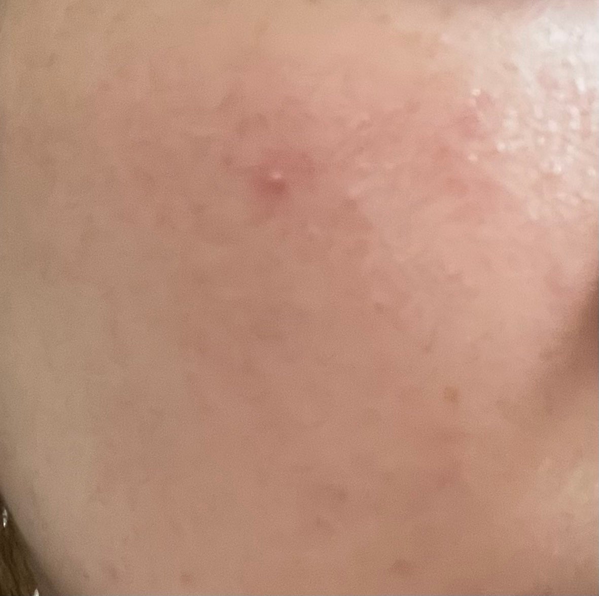 ビタCICA マスク/クリアターン/シートマスク・パックを使ったクチコミ(2枚目)