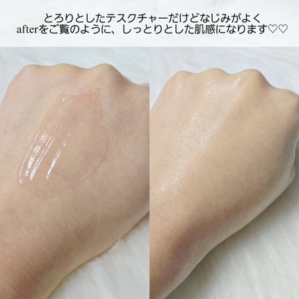 PDRNショット 1000+/fractionalCC/美容液を使ったクチコミ(4枚目)