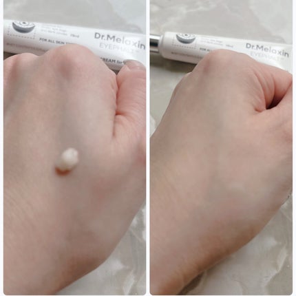 アイファルトアイバッククリーム/Dr.Melaxin/アイケア・アイクリームを使ったクチコミ(5枚目)