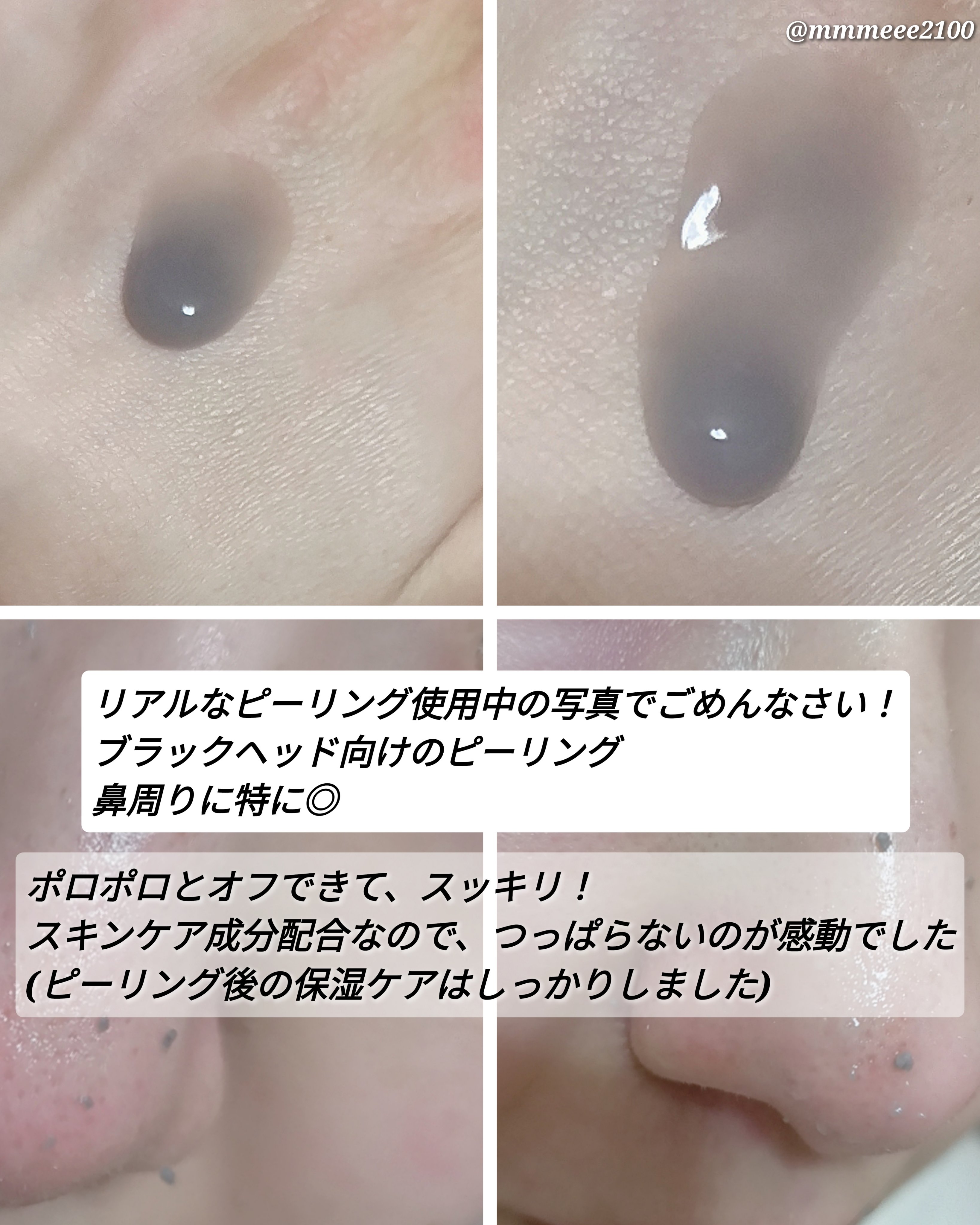 白米ピールショットゴマージュアンプル/Dr.Melaxin/美容液を使ったクチコミ（3枚目）