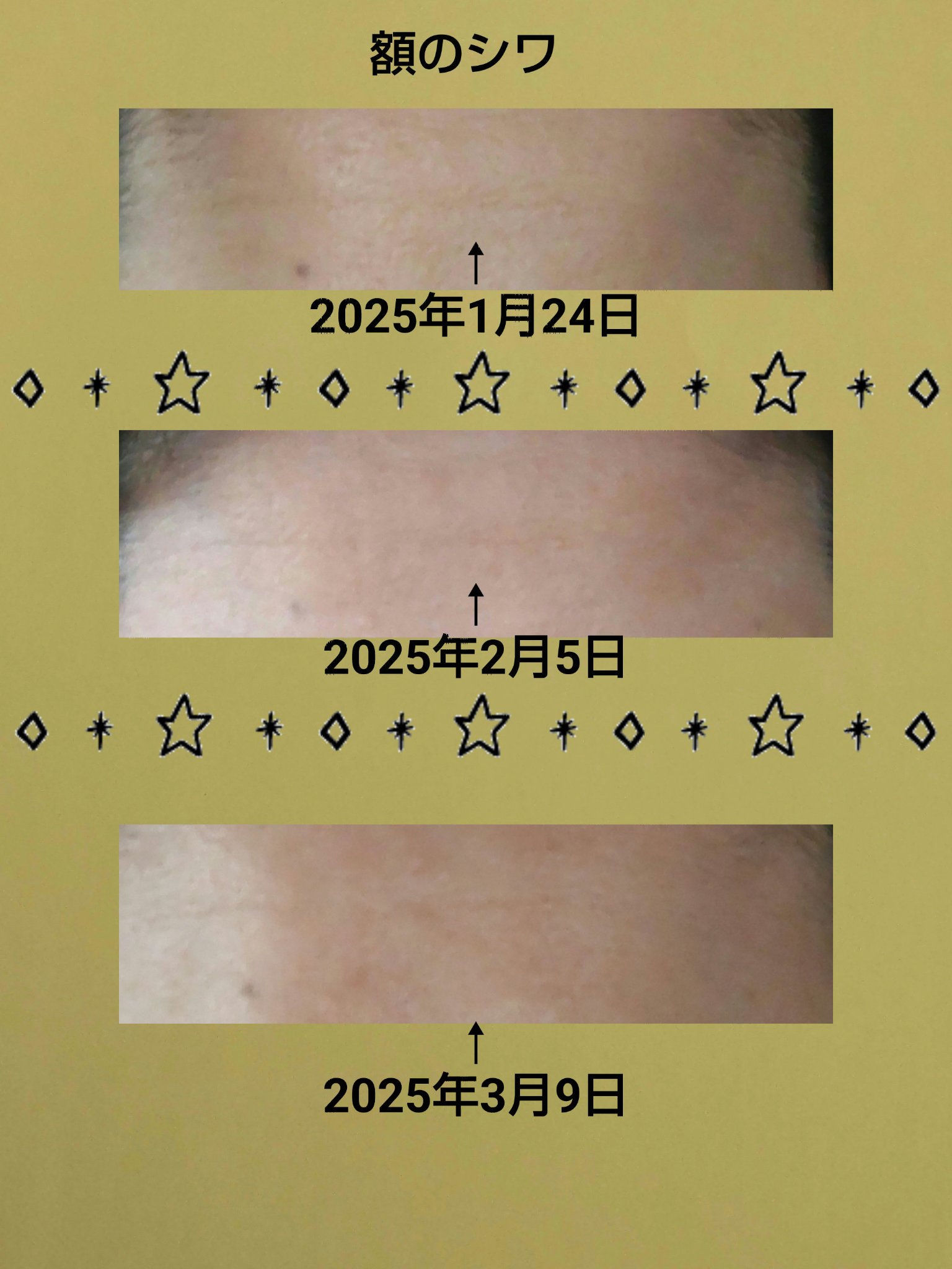 バイタルパーフェクション リンクルリフト ディープレチノホワイト5/SHISEIDO/フェイスクリームを使ったクチコミ（3枚目）