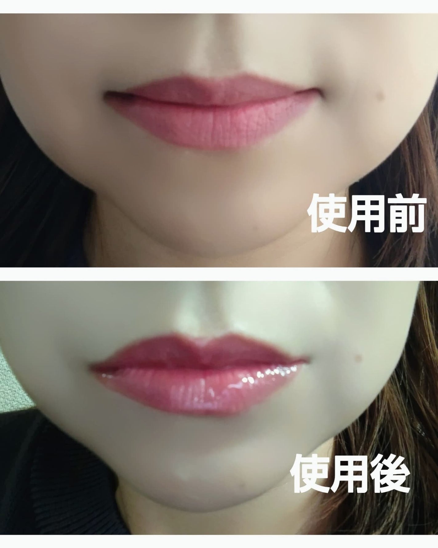 あいちゃん3人のママ on LIPS 「フラクショナルCCPDRNショットリップエッセンス/PDRNシ..」(7枚目)