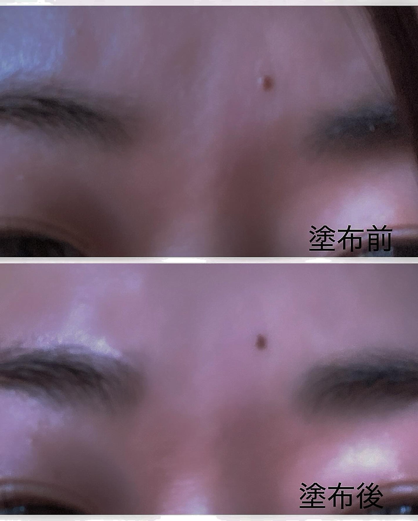 アイファルトアイバッククリーム/Dr.Melaxin/アイケア・アイクリームを使ったクチコミ(3枚目)