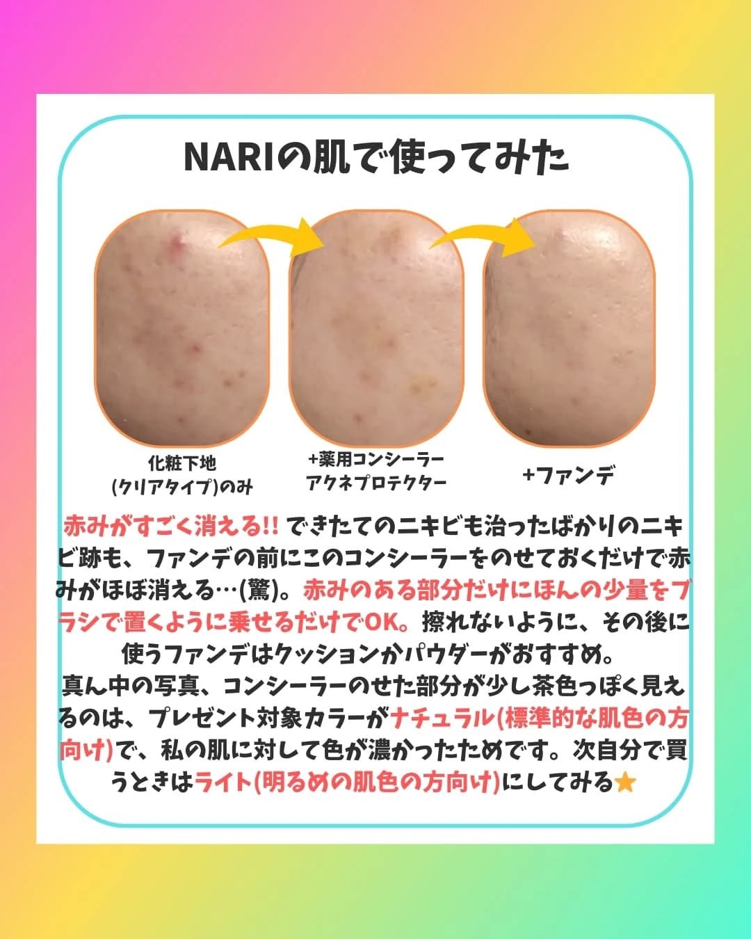 薬用コンシーラー アクネプロテクター/ONLY MINERALS/パウダーコンシーラーを使ったクチコミ（3枚目）