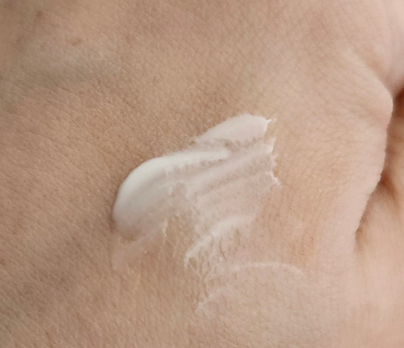 ダーマセプトRX VAセラム/ダーマセプトRX/美容液を使ったクチコミ(2枚目)