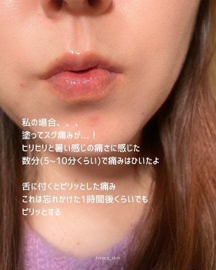 ウォーターフルリッププランパー/COSNORI/リッププランパーを使ったクチコミ(5枚目)