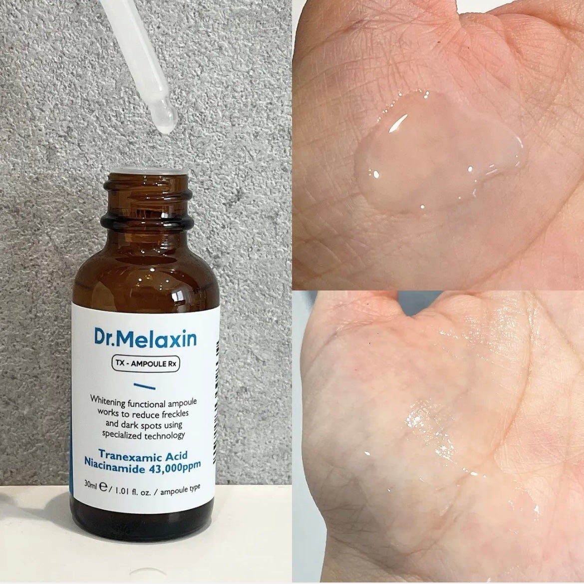 TXアンプルRX+TXクリーム/Dr.Melaxin/スキンケアキットを使ったクチコミ(2枚目)