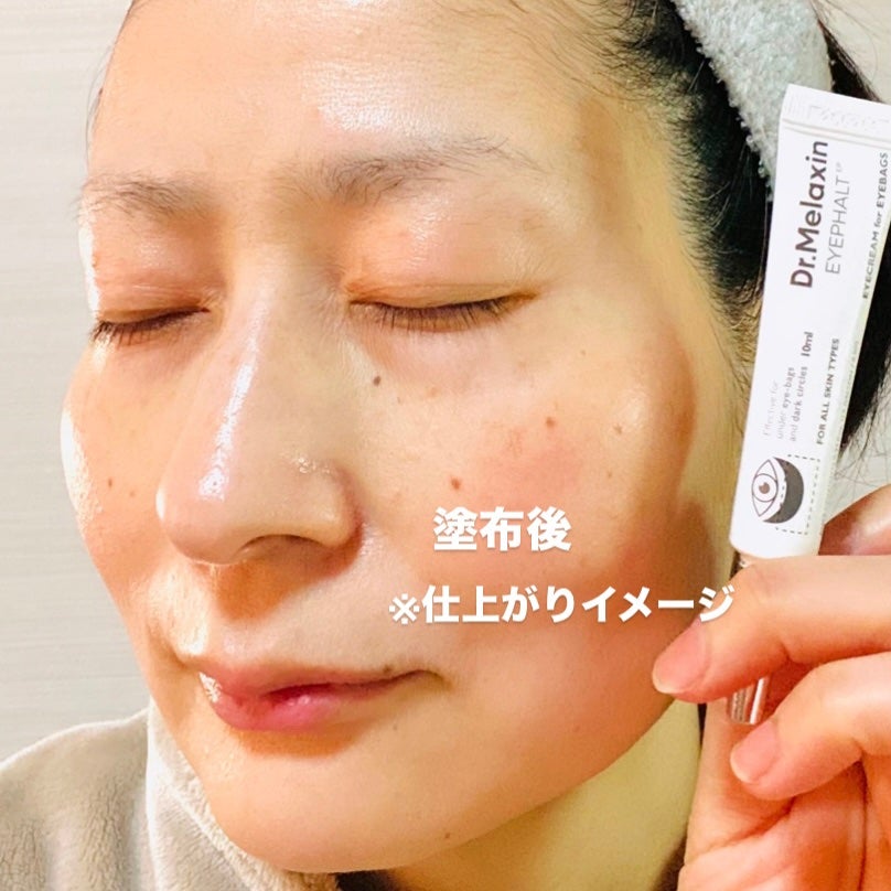 アイファルトアイバッククリーム/Dr.Melaxin/アイケア・アイクリームを使ったクチコミ(4枚目)