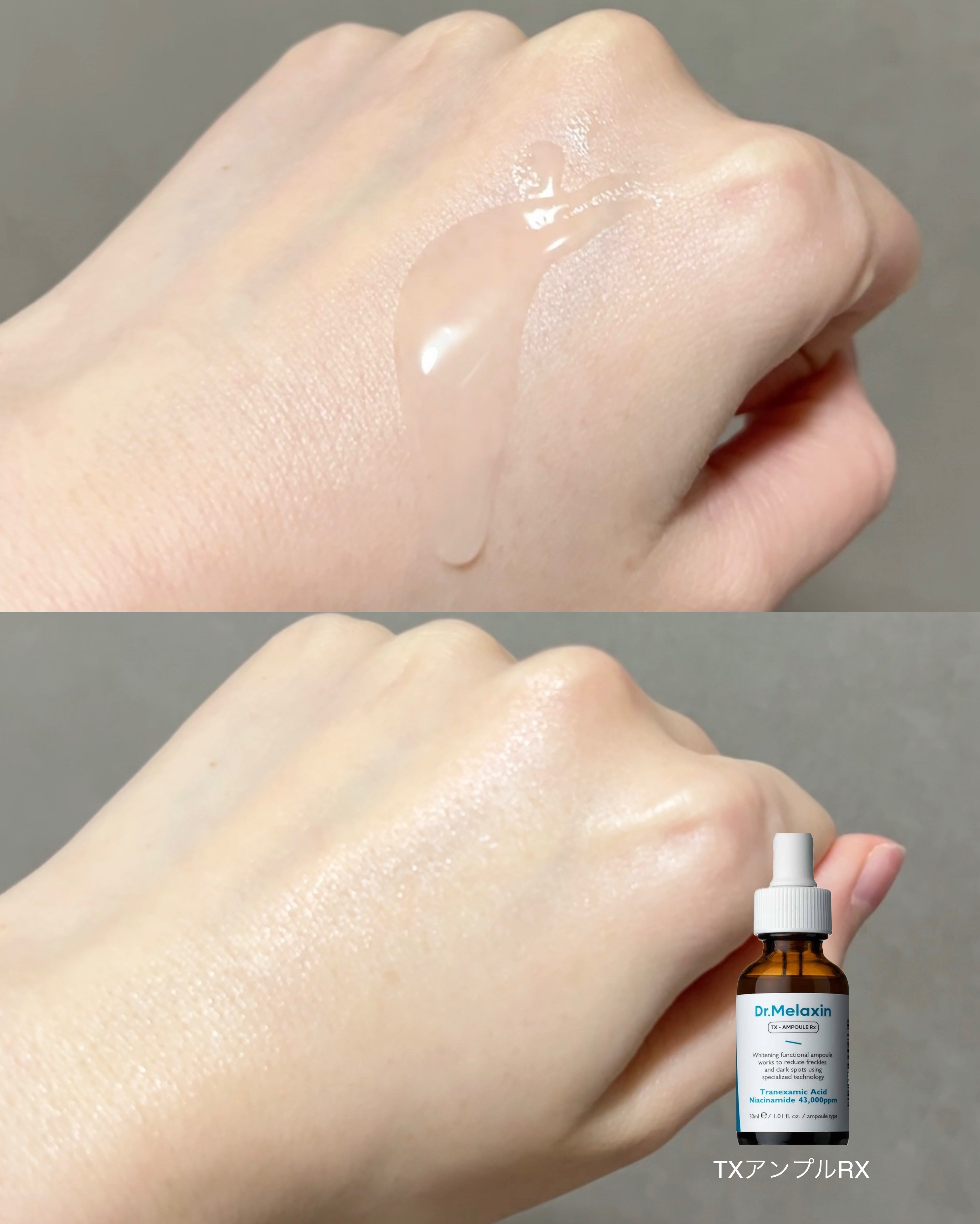 TX - AMPOULE Rx/Dr.Melaxin/美容液を使ったクチコミ（2枚目）