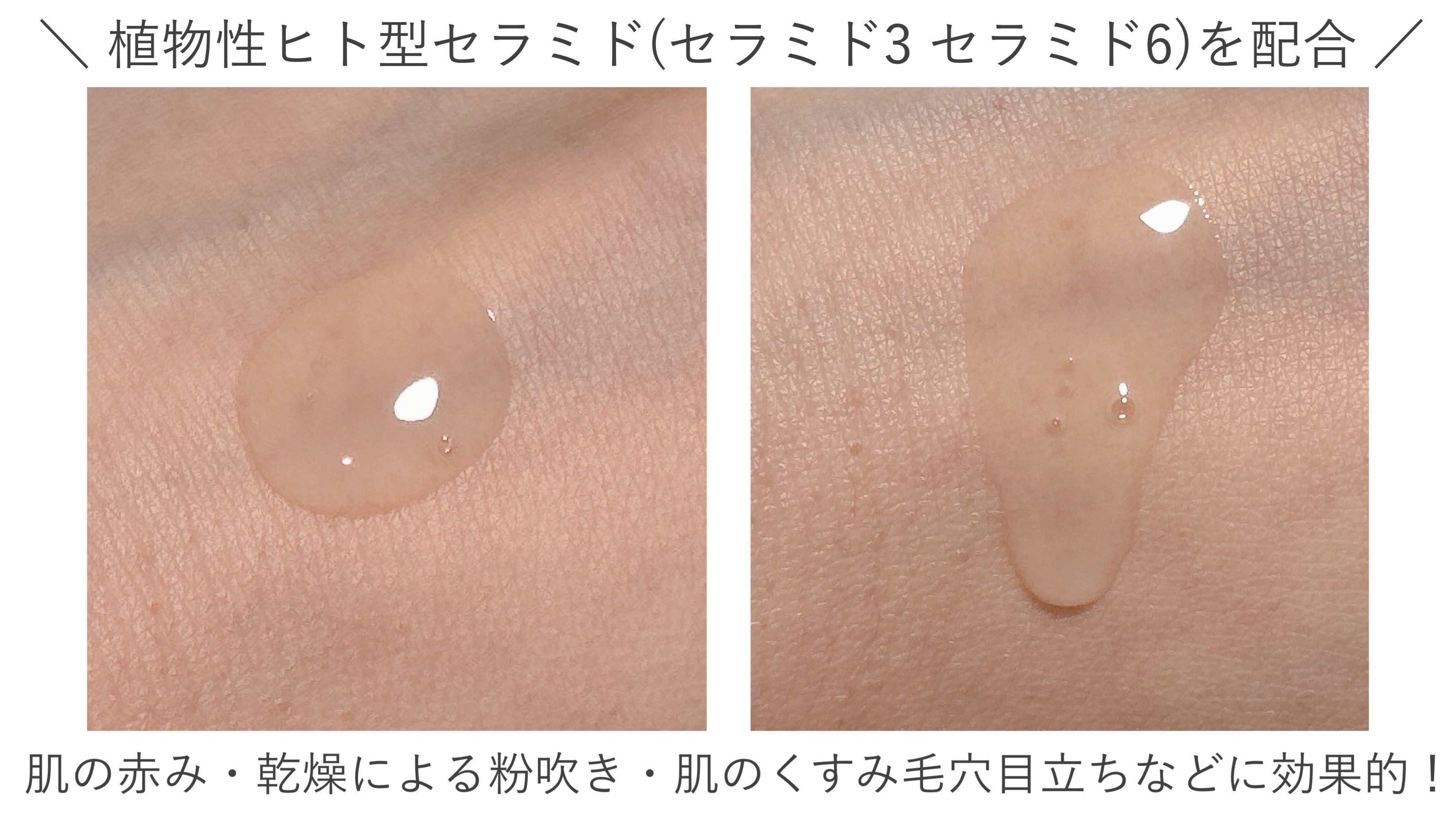 イチジクセラミド美容液/chant a charm /美容液を使ったクチコミ（2枚目）