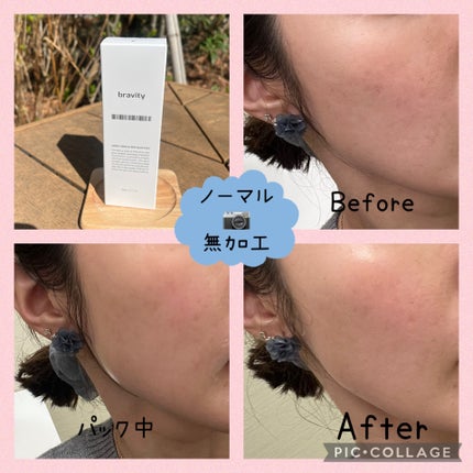 ダーマステムセルディープグローパック/bravity/シートマスク・パックを使ったクチコミ(5枚目)