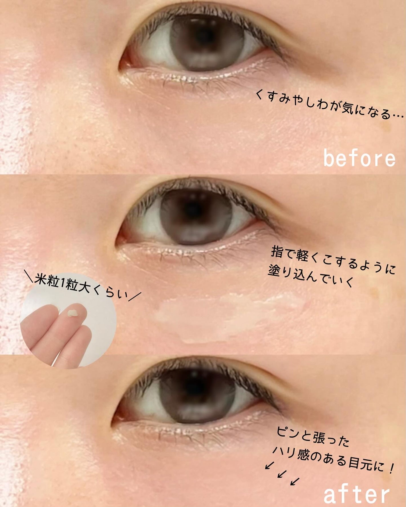 アイファルトアイバッククリーム/Dr.Melaxin/アイケア・アイクリームを使ったクチコミ(3枚目)