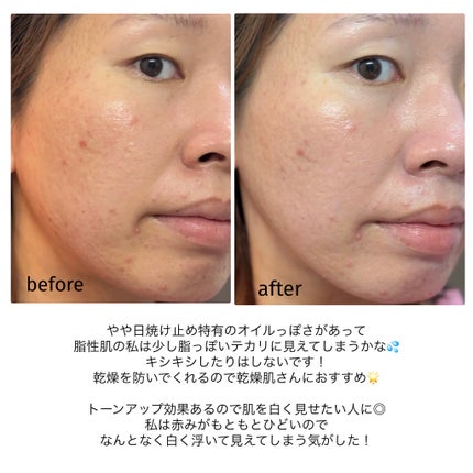 ミネラルUVアクアプロテクター/エトヴォス/日焼け止めローションを使ったクチコミ(7枚目)