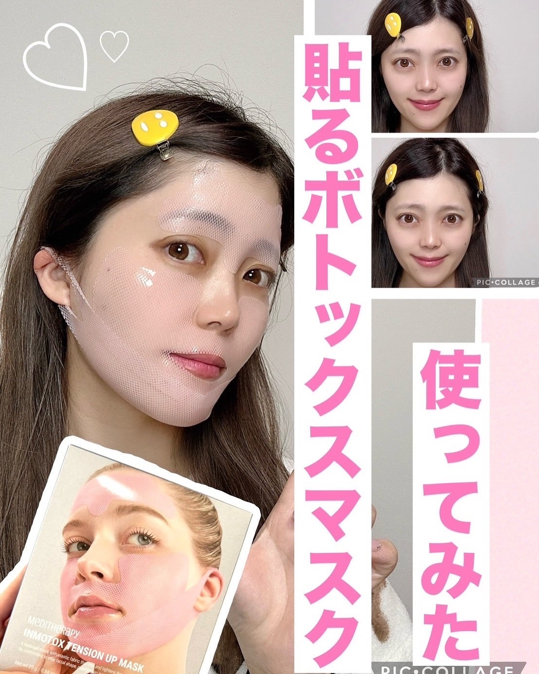 インモトックステンションアップマスク/MEDITHERAPY/シートマスク・パックを使ったクチコミ(1枚目)