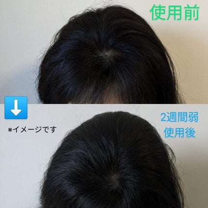 OR 薬用育毛剤/Off&Relax/頭皮ローションを使ったクチコミ(4枚目)