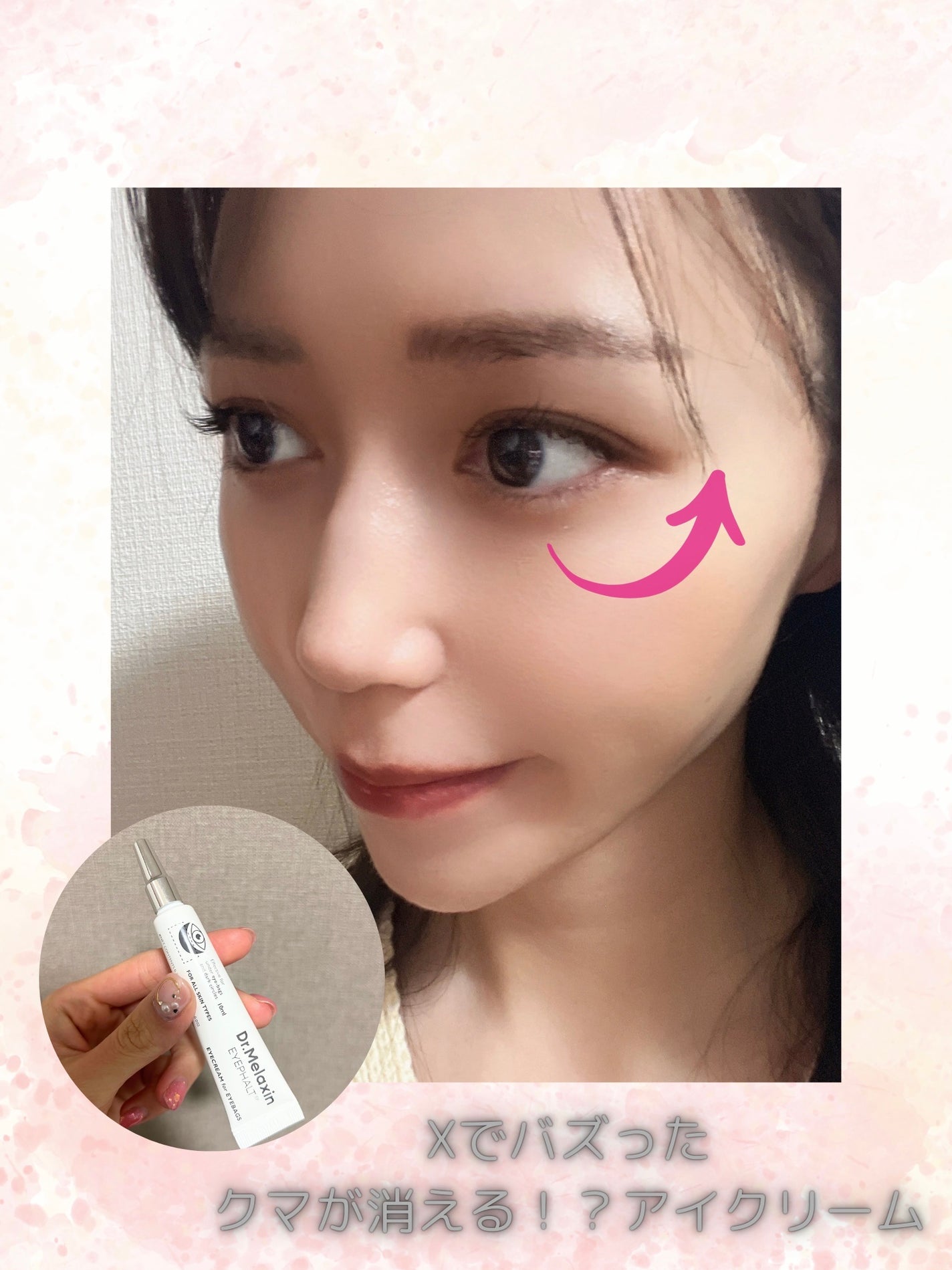 アイファルトアイバッククリーム/Dr.Melaxin/アイケア・アイクリームを使ったクチコミ(1枚目)