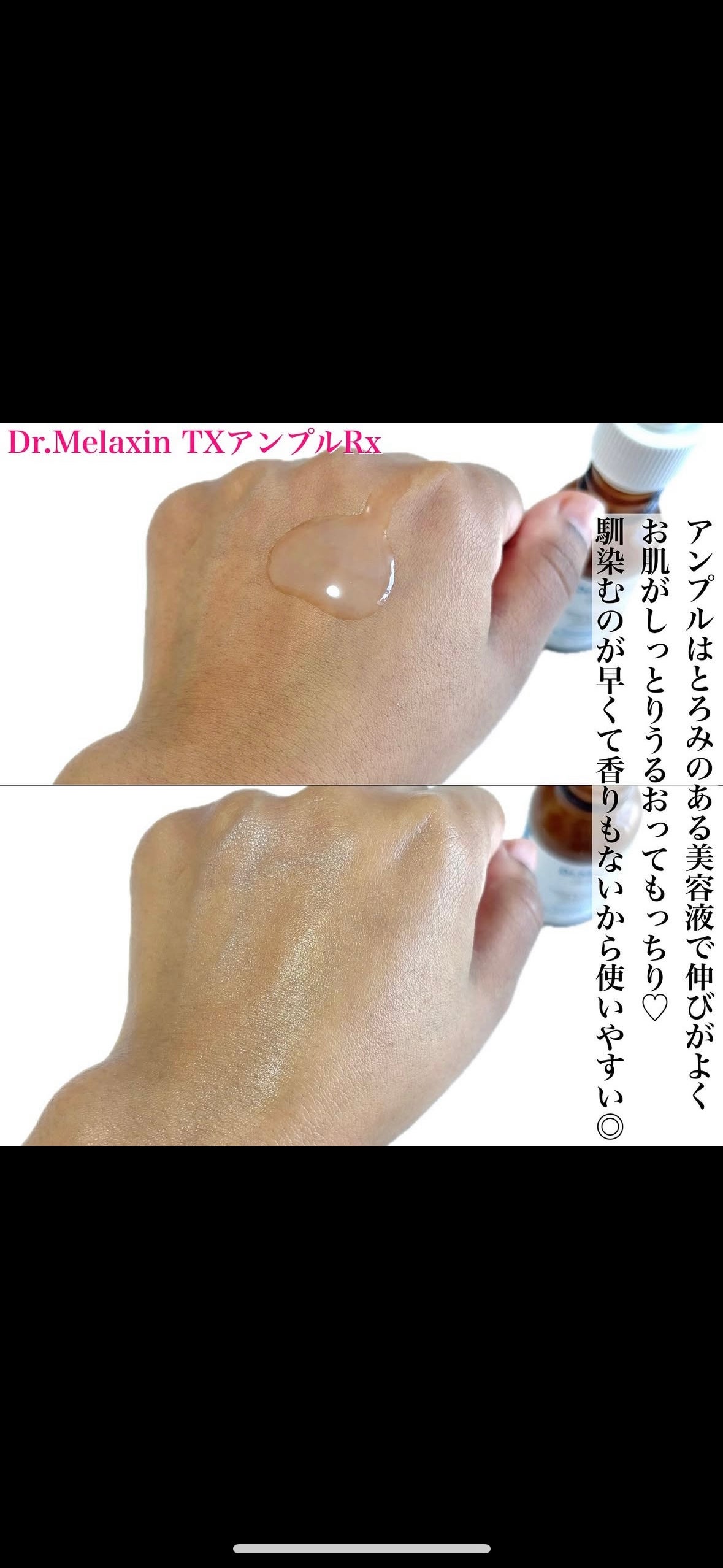 TXアンプルRX+TXクリーム/Dr.Melaxin/スキンケアキットを使ったクチコミ(4枚目)