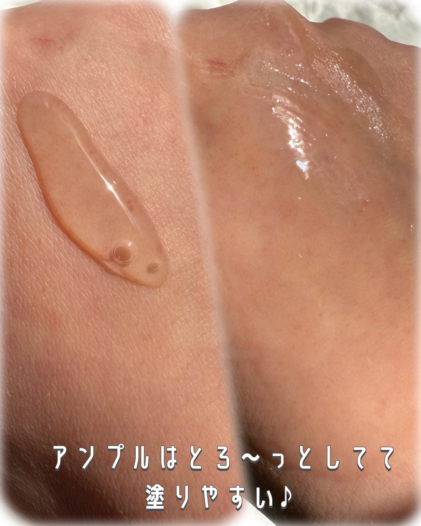 セメンリトカルシウムアンプル+セメンリトカルシウムクリーム/Dr.Melaxin/スキンケアキットを使ったクチコミ(4枚目)