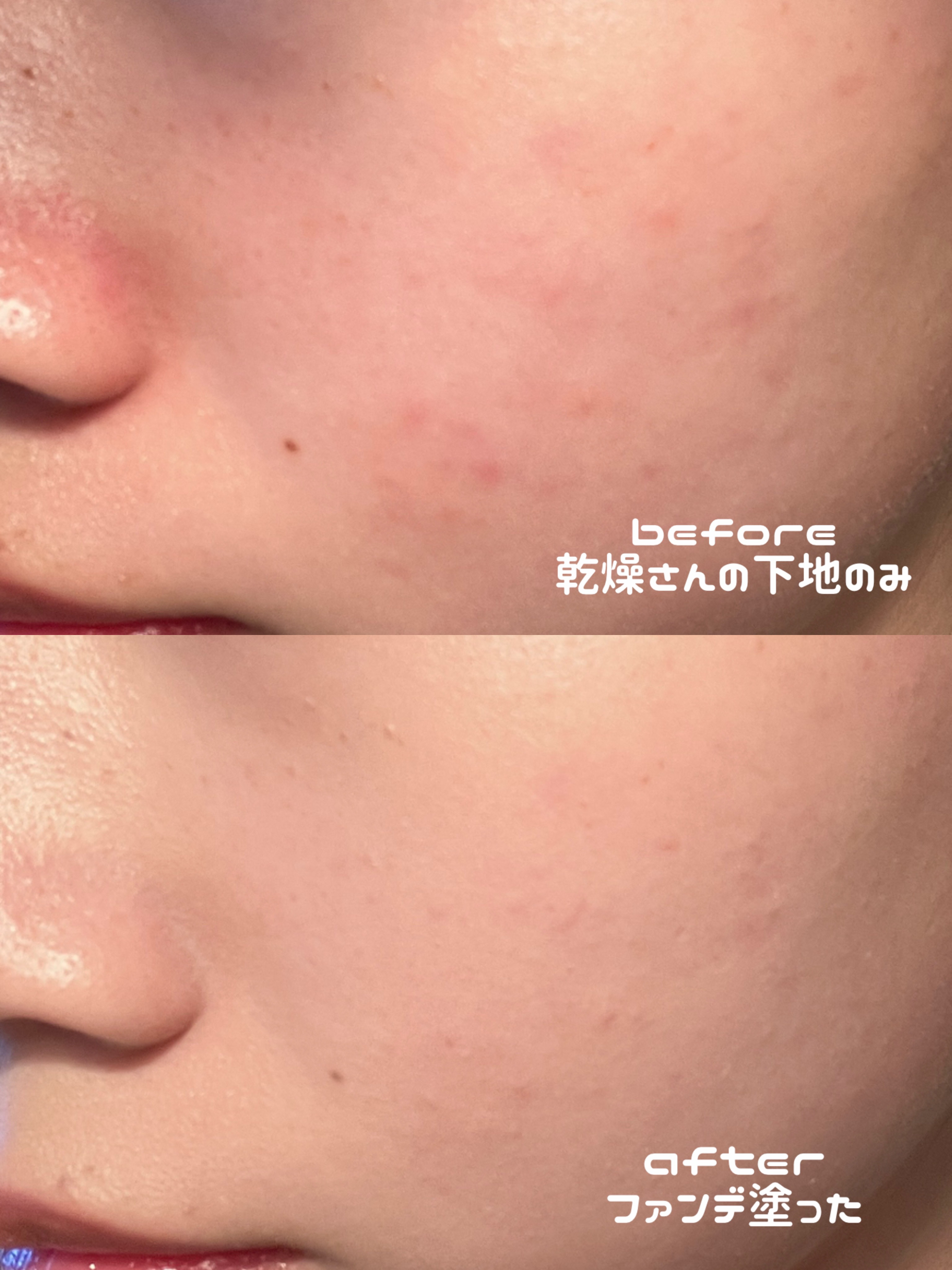 フィー 3Dボリューミンググロス/fwee/リップグロスを使ったクチコミ（3枚目）