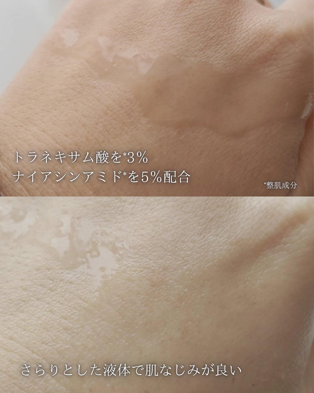 TXナイアシンエッセンストナー/SKIN&LAB/化粧水を使ったクチコミ(3枚目)