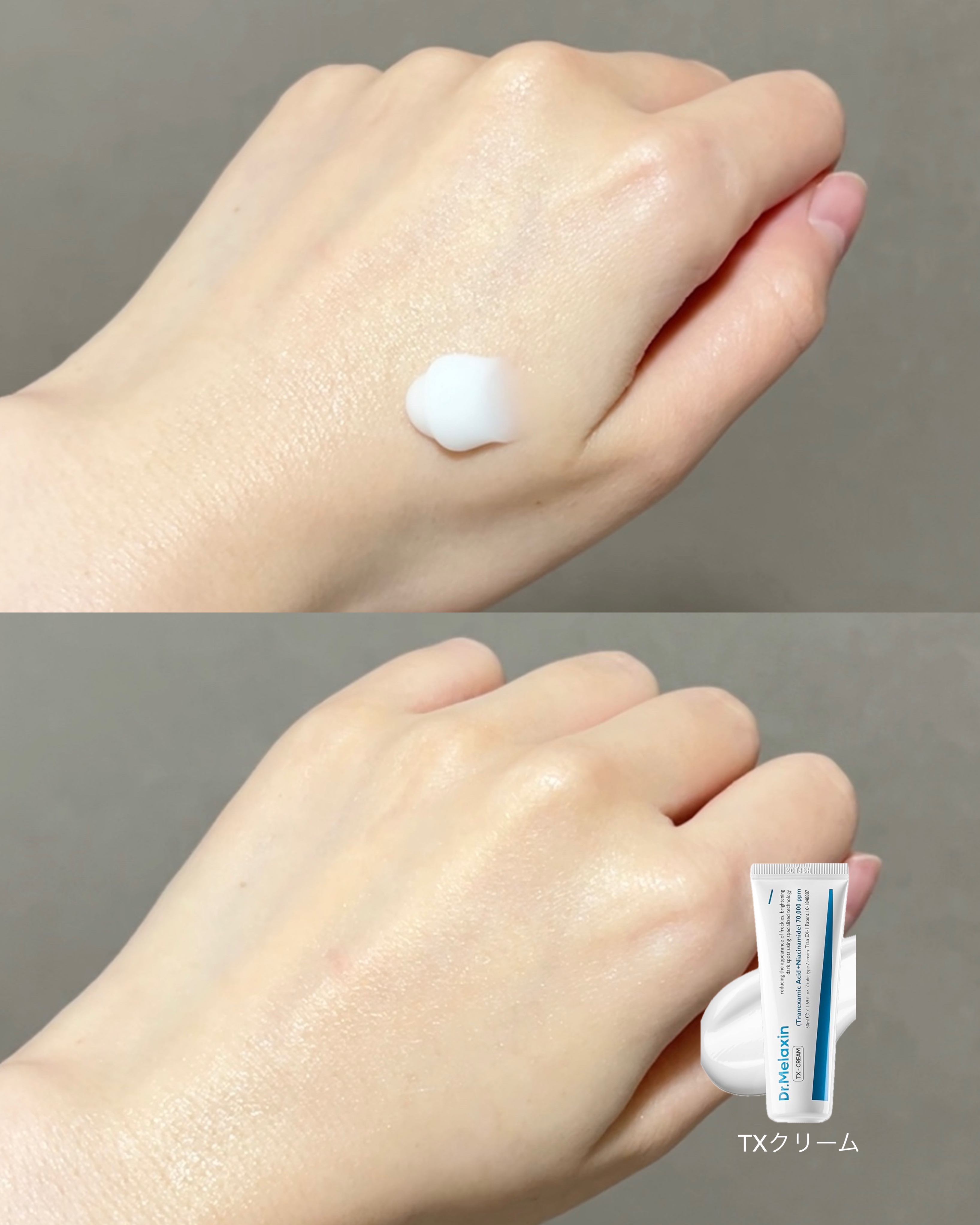 TX - AMPOULE Rx/Dr.Melaxin/美容液を使ったクチコミ（3枚目）