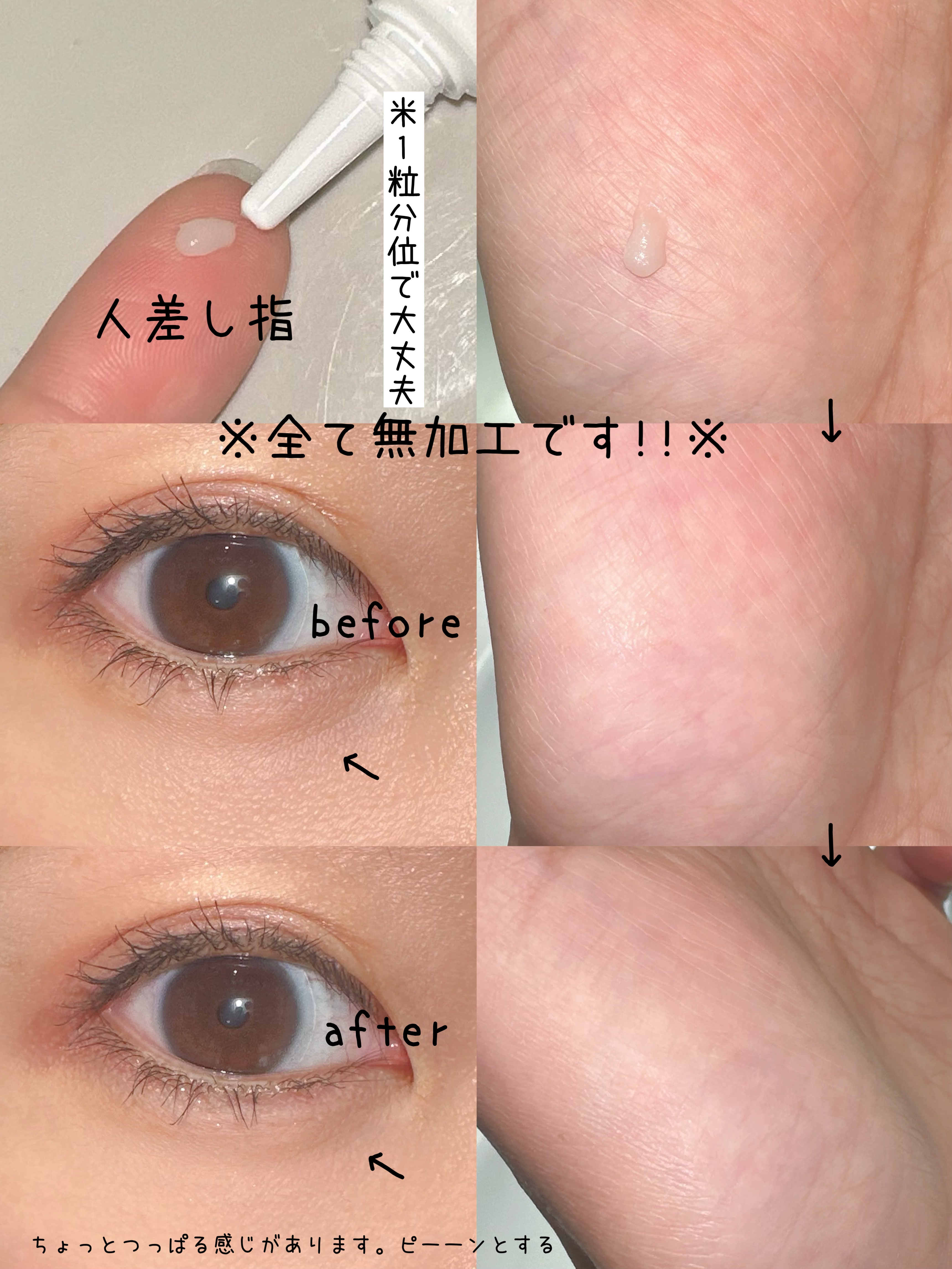 アイファルトアイバッククリーム/Dr.Melaxin/アイケア・アイクリームを使ったクチコミ（2枚目）