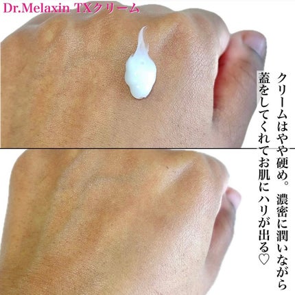 TXアンプルRX+TXクリーム/Dr.Melaxin/スキンケアキットを使ったクチコミ(5枚目)