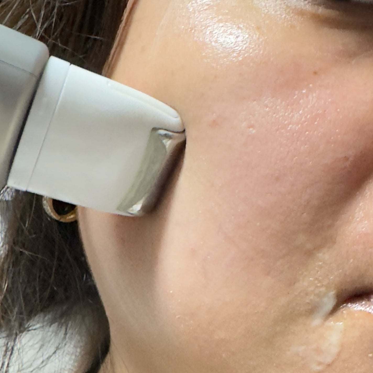 レチノールリフティングローラークリーム/SKIN&LAB/フェイスクリームを使ったクチコミ(3枚目)