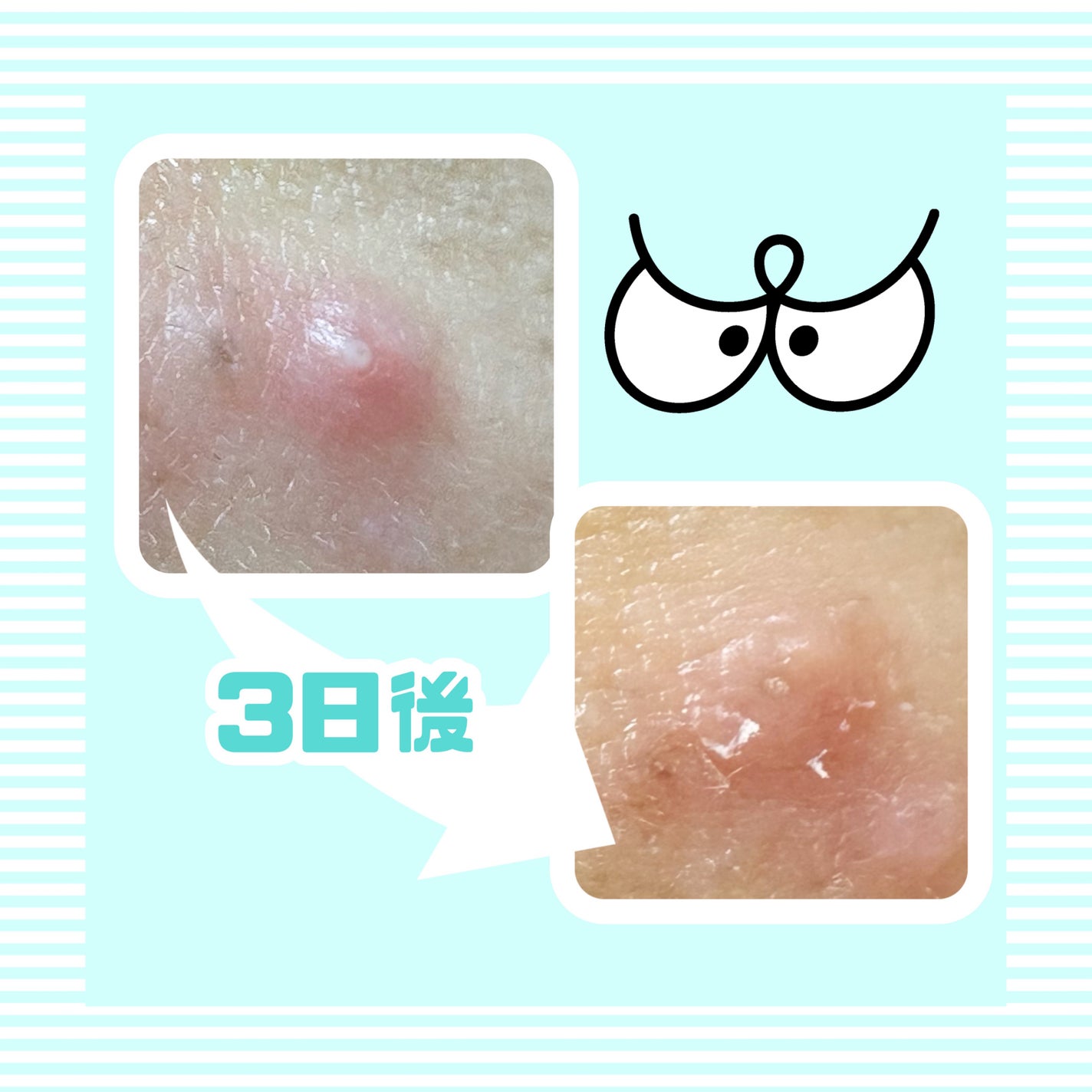 マジックティーツリーオイル/ブラン/フェイスオイルを使ったクチコミ(2枚目)