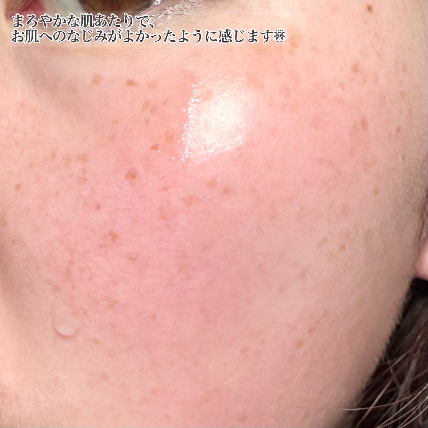 アイムユアヒーロー モイストピールケアセラム/SISI/美容液を使ったクチコミ（3枚目）