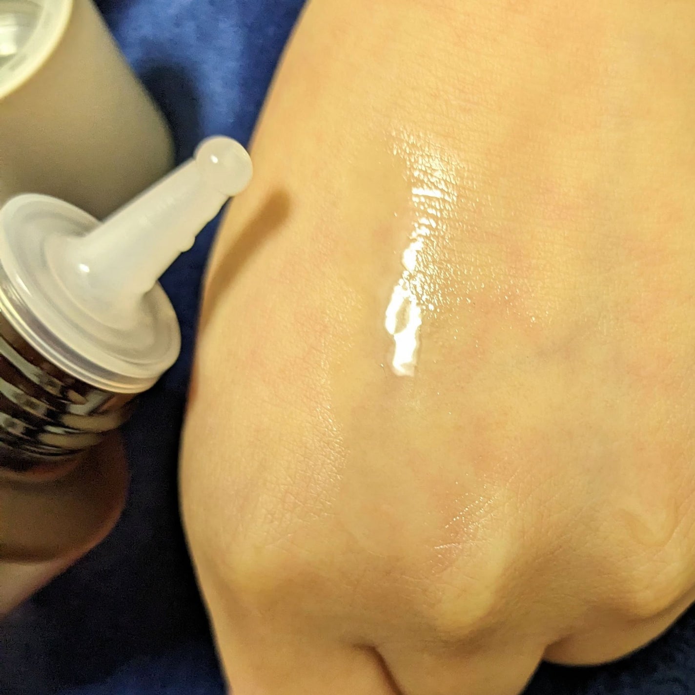 OR 薬用育毛剤/Off&Relax/頭皮ローションを使ったクチコミ(6枚目)