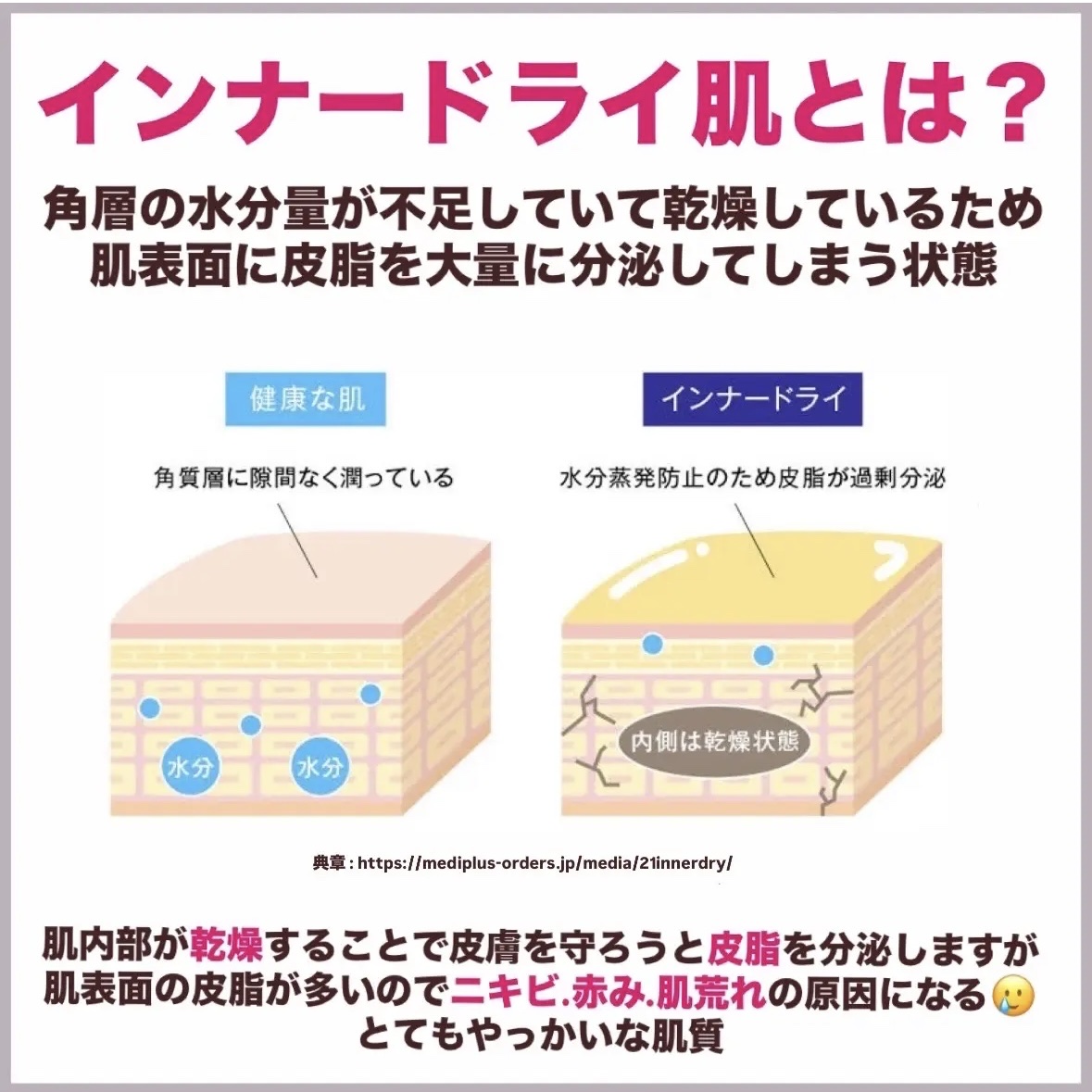 エクストリームエッセンストナーオリジナル/Real Barrier/化粧水を使ったクチコミ（2枚目）