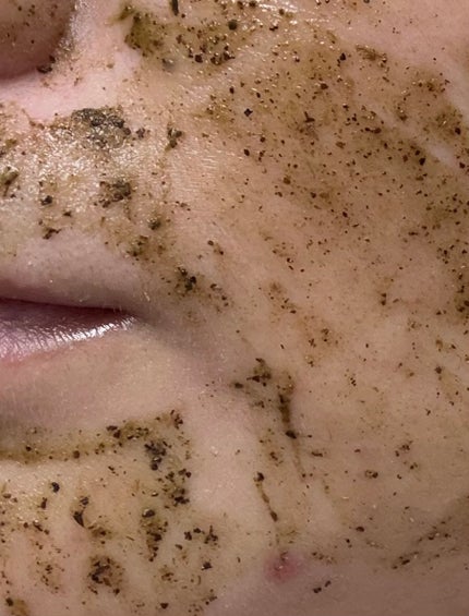 ティーツリーハーブピーリングパック/WellDerma/洗い流すパック・マスクを使ったクチコミ(2枚目)