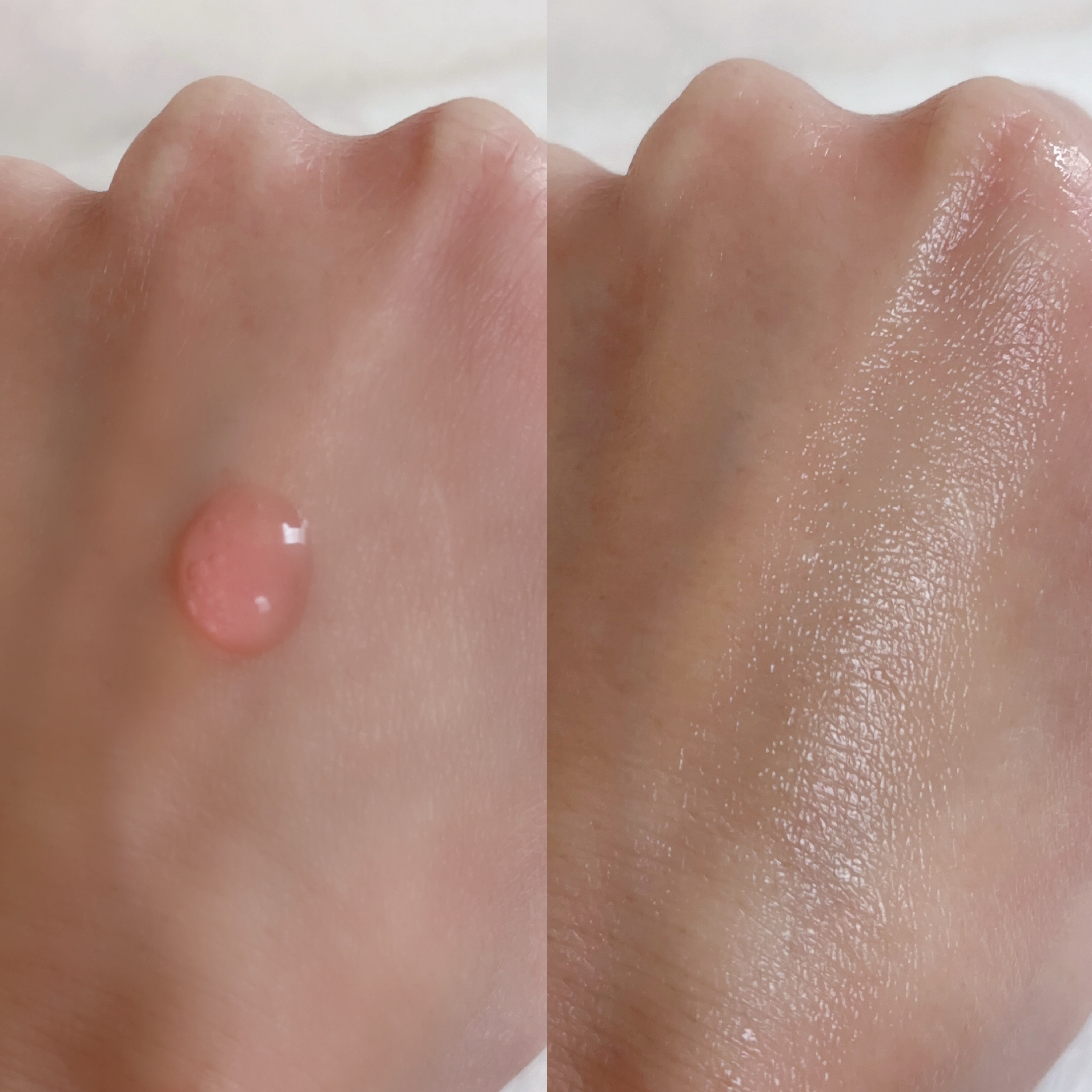 PDRNショット 1000＋/fractionalCC/美容液を使ったクチコミ（3枚目）