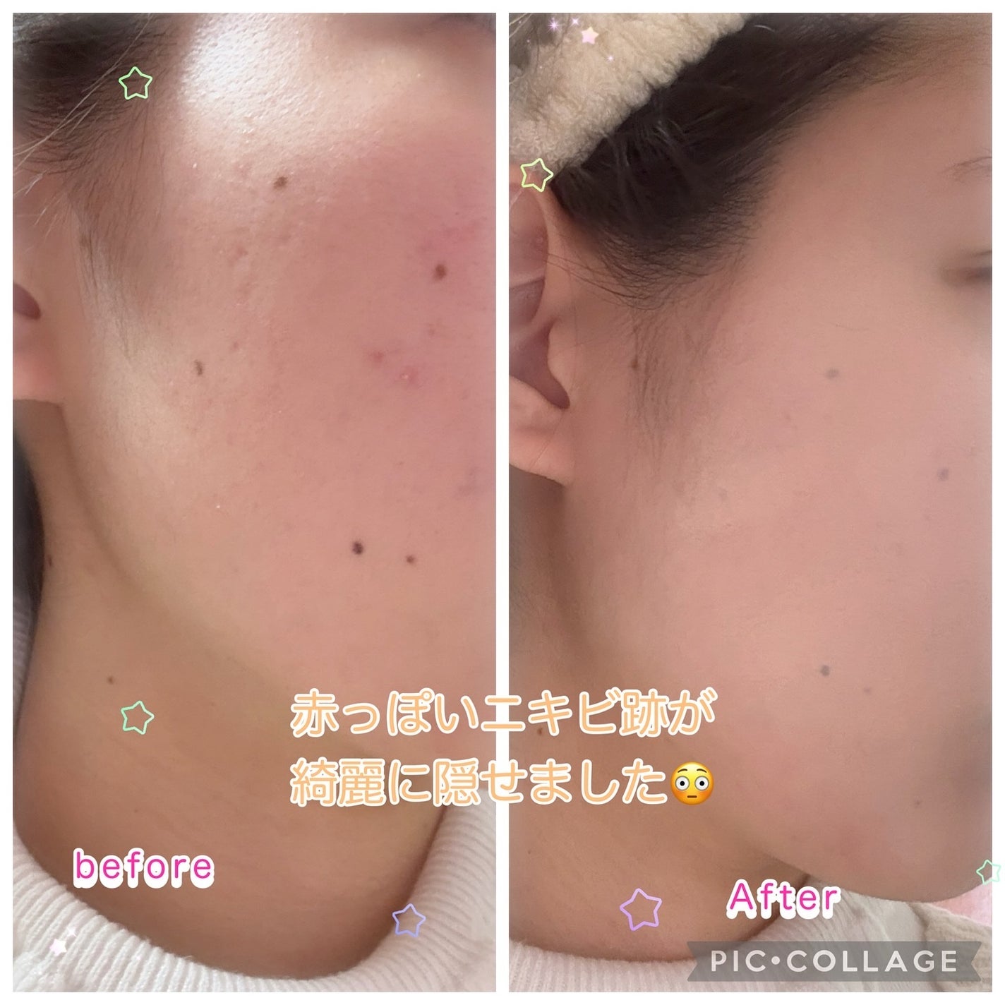 ダーマシンコンシーラー/23years old/リキッドコンシーラーを使ったクチコミ(3枚目)