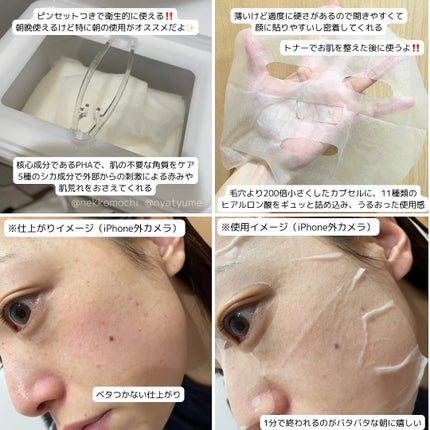 レッドブレミッシュクイックPHAシートマスク/Dr.G/シートマスク・パックを使ったクチコミ(2枚目)