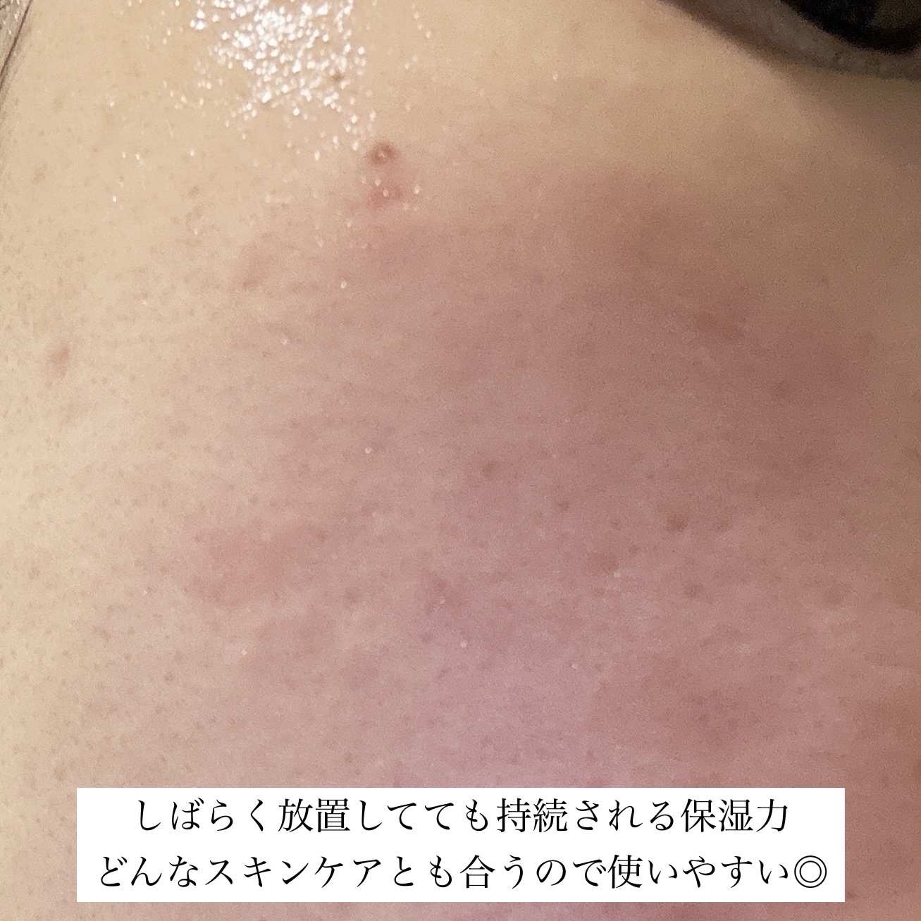 ダイブイン セラム/Torriden/美容液を使ったクチコミ（3枚目）