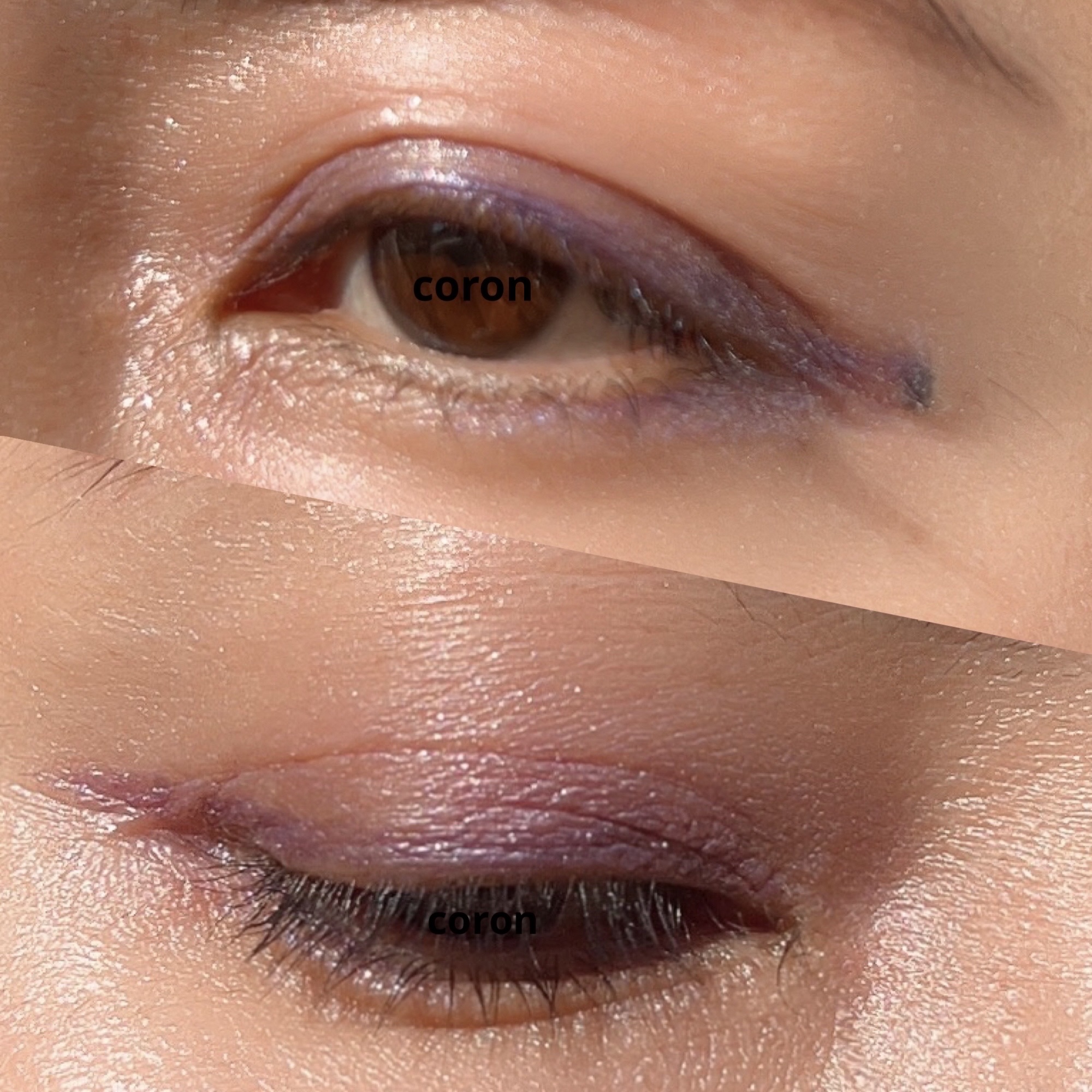 チーク ポップ/CLINIQUE/パウダーチークを使ったクチコミ（2枚目）