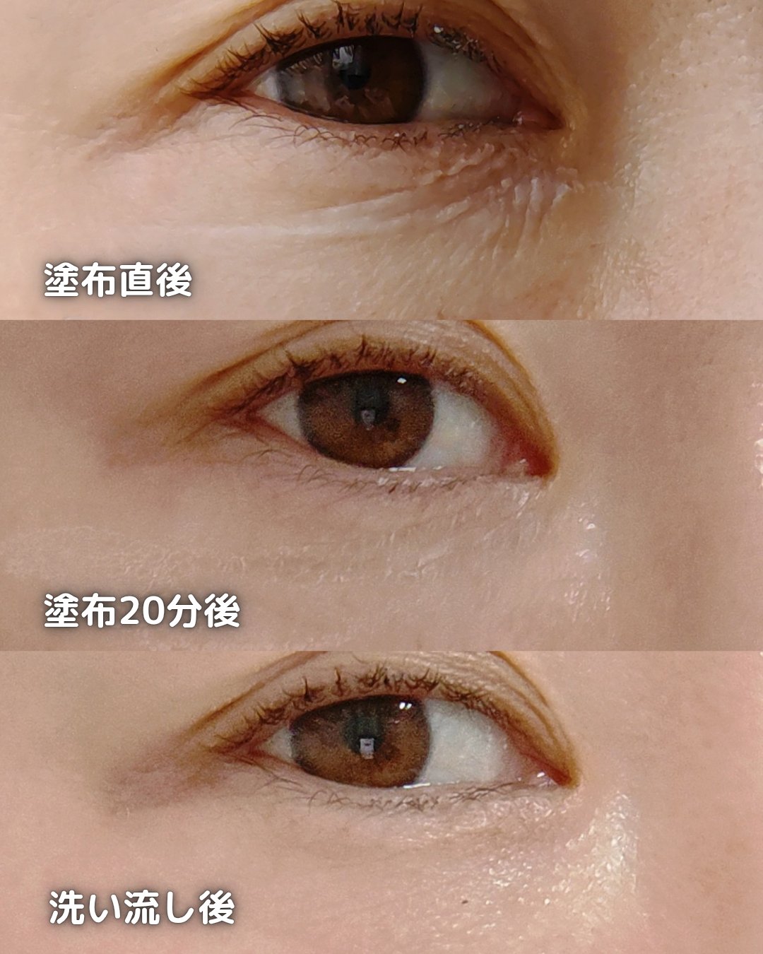 アイファルトアイバッククリーム/Dr.Melaxin/アイケア・アイクリームを使ったクチコミ（3枚目）