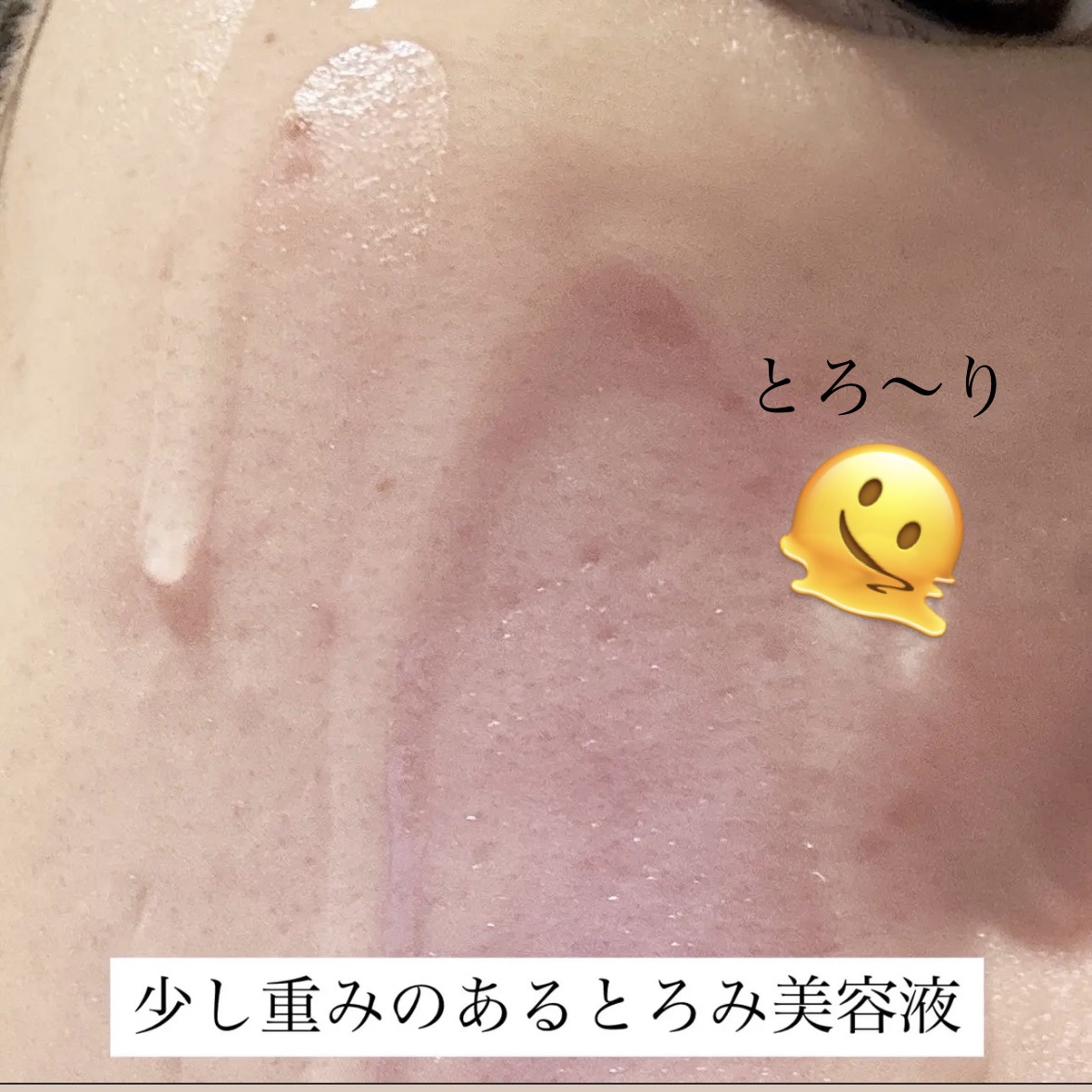 ダイブイン セラム/Torriden/美容液を使ったクチコミ（2枚目）