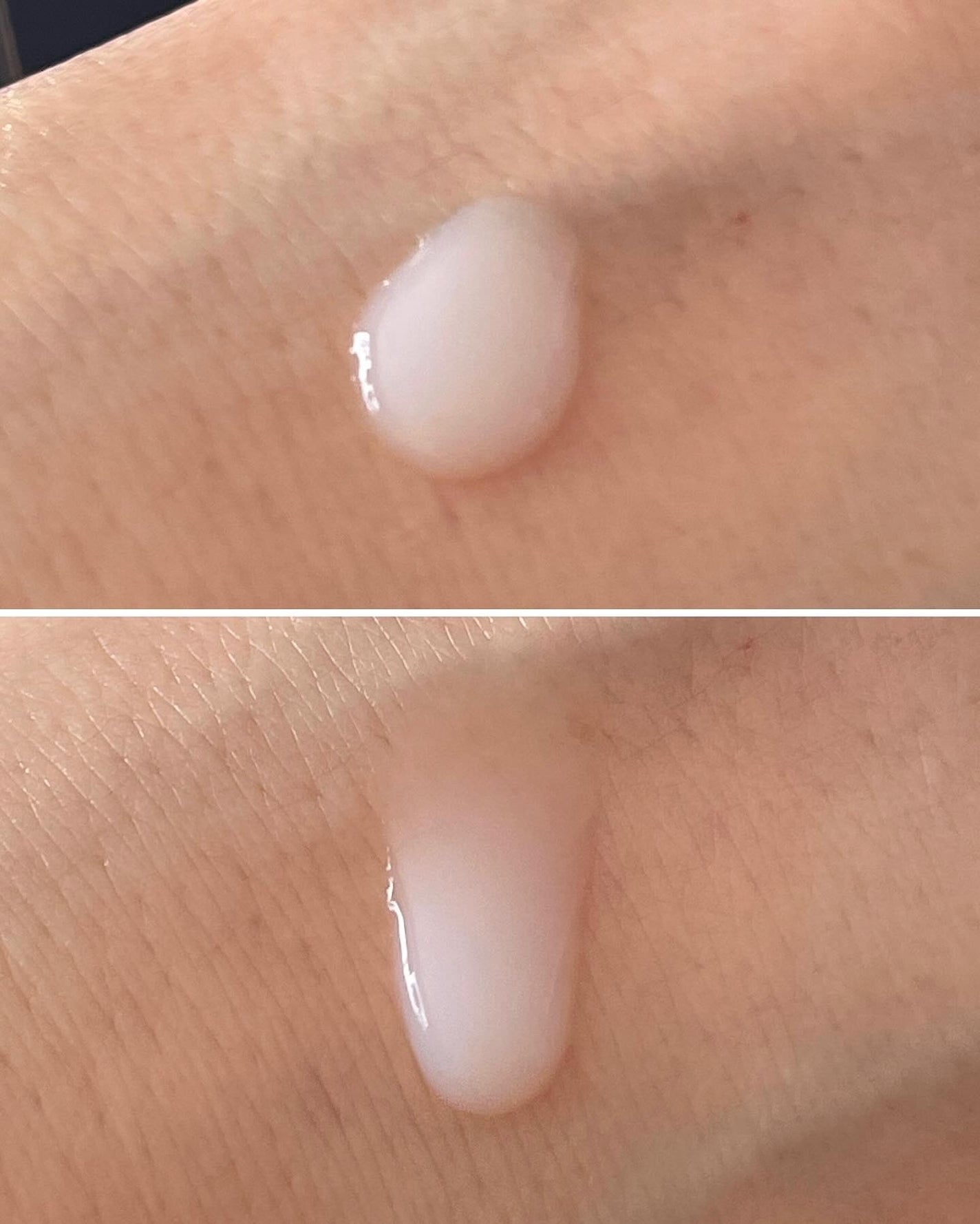 シンピ 導入美容液/fracora/美容液を使ったクチコミ(5枚目)