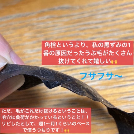 ソフティモ 角栓すっきり黒パック/ソフティモ/シートマスク・パックを使ったクチコミ(5枚目)