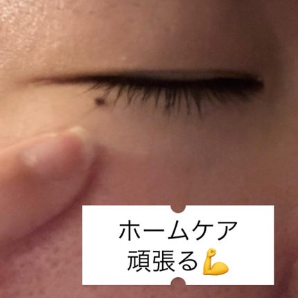 アイファルトアイバッククリーム/Dr.Melaxin/アイケア・アイクリームを使ったクチコミ(5枚目)