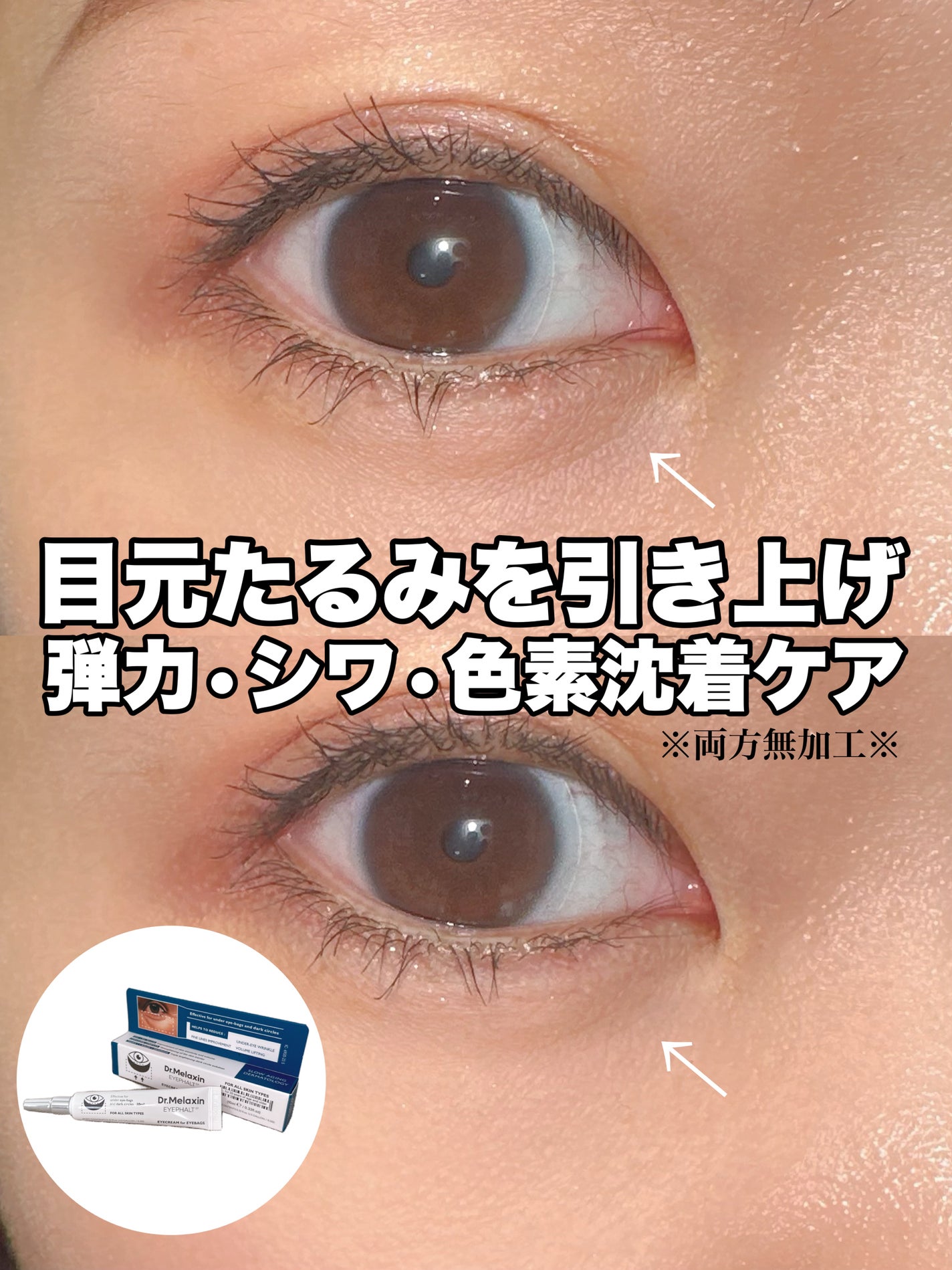 アイファルトアイバッククリーム/Dr.Melaxin/アイケア・アイクリームを使ったクチコミ(1枚目)