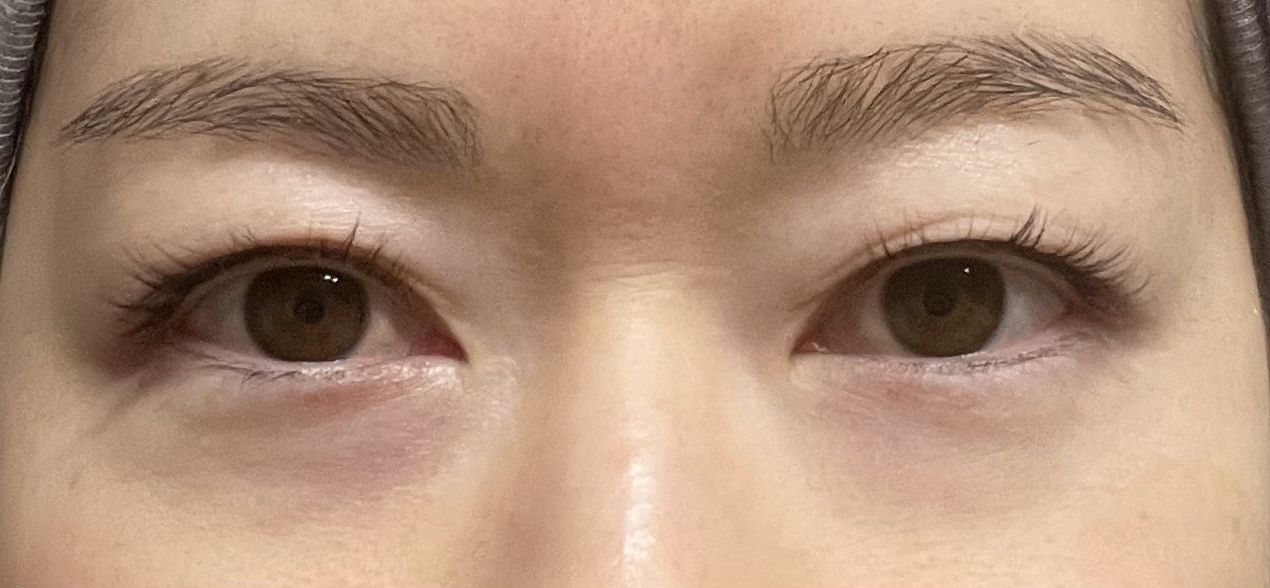 アイファルトアイバッククリーム/Dr.Melaxin/アイケア・アイクリームを使ったクチコミ（3枚目）