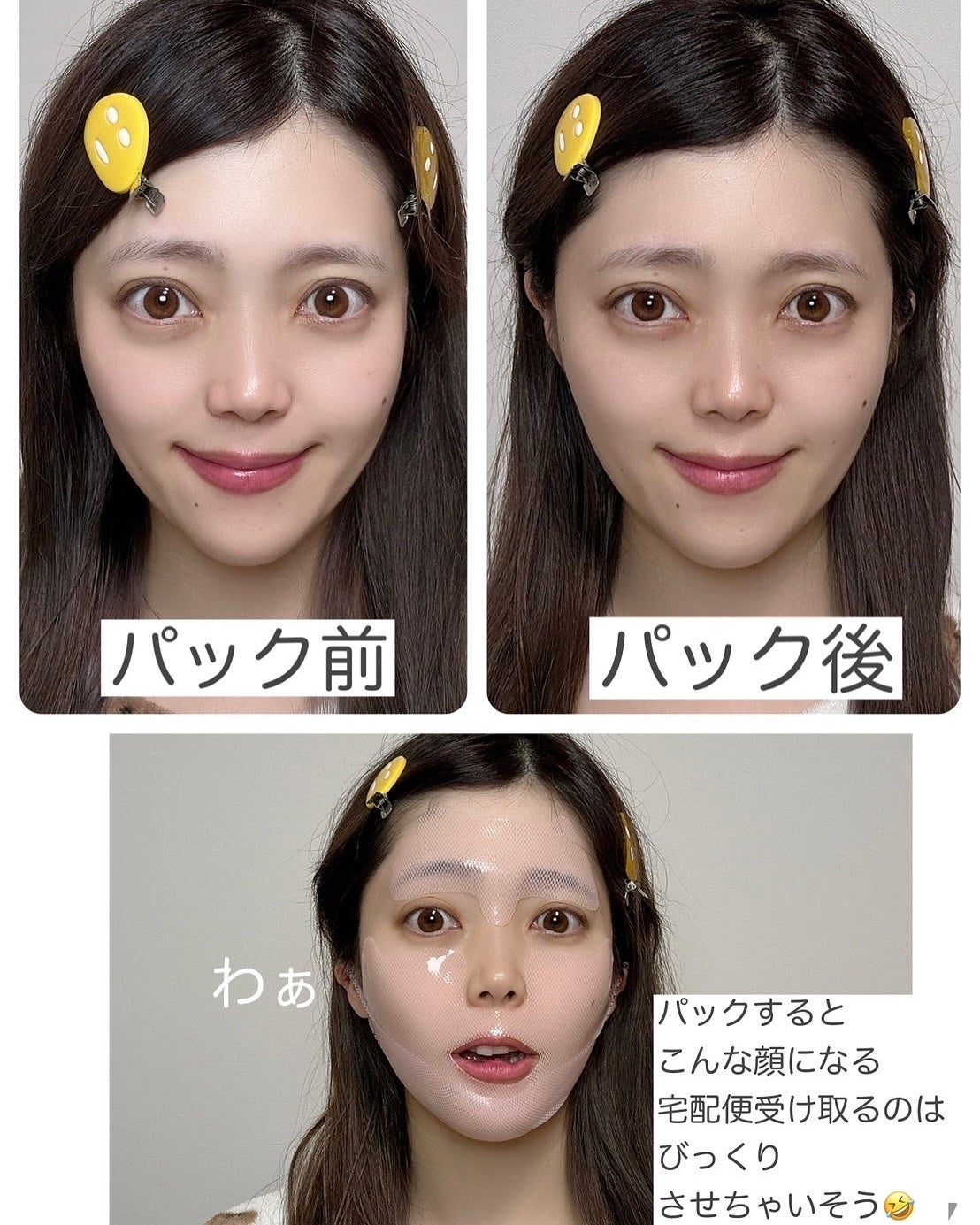 インモトックステンションアップマスク/MEDITHERAPY/シートマスク・パックを使ったクチコミ(4枚目)