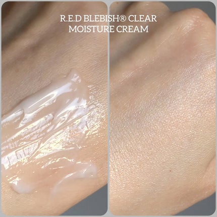 レッドブレミッシュ クリアスージングクリーム/Dr.G/フェイスクリームを使ったクチコミ(4枚目)